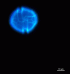 Alexandrium minutum, stained with calcofluor and observed under epifluorescence microscopy (Photo: Nagore Sampedro)